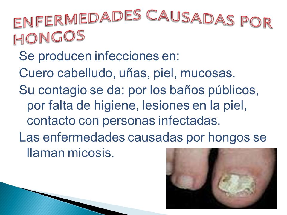 enfermedad de la piel infección por hongos fotos enfermedad de la piel infección por hongos fotos